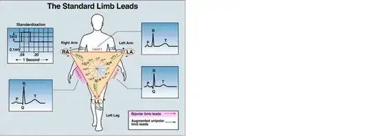 ecg lead connection