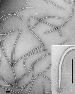 Electron micrographs of Sulfolobus islandicus filamentous virus, a lipothrixvirus.