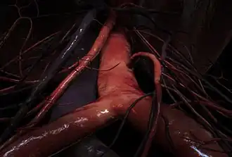 A 3D animation still of the junction between the common iliac artery and the lower abdominal aorta