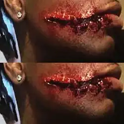 Two of the same images of a bloody scar on a man's face