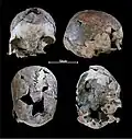 Burial 05 - Cranium