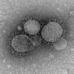MERS-CoV particles as seen by negative stain electron microscopy. Virions contain characteristic club-like projections emanating from the viral membrane.