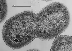 TEM of Prochlorococcus MED4 dividing