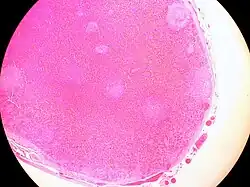Histologic section of an accessory spleen